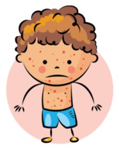 Detergent Allergy Symptoms